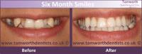 Ascent Dental Care Tamworth image 1